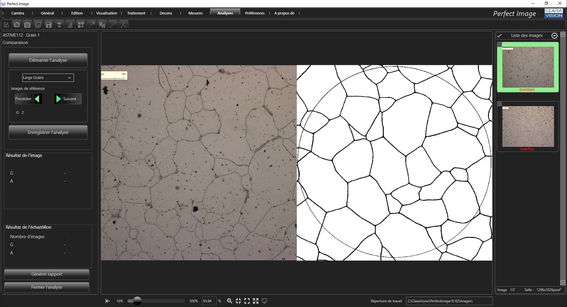 Analyse taille de grains en metallographie selon la norme Astme112